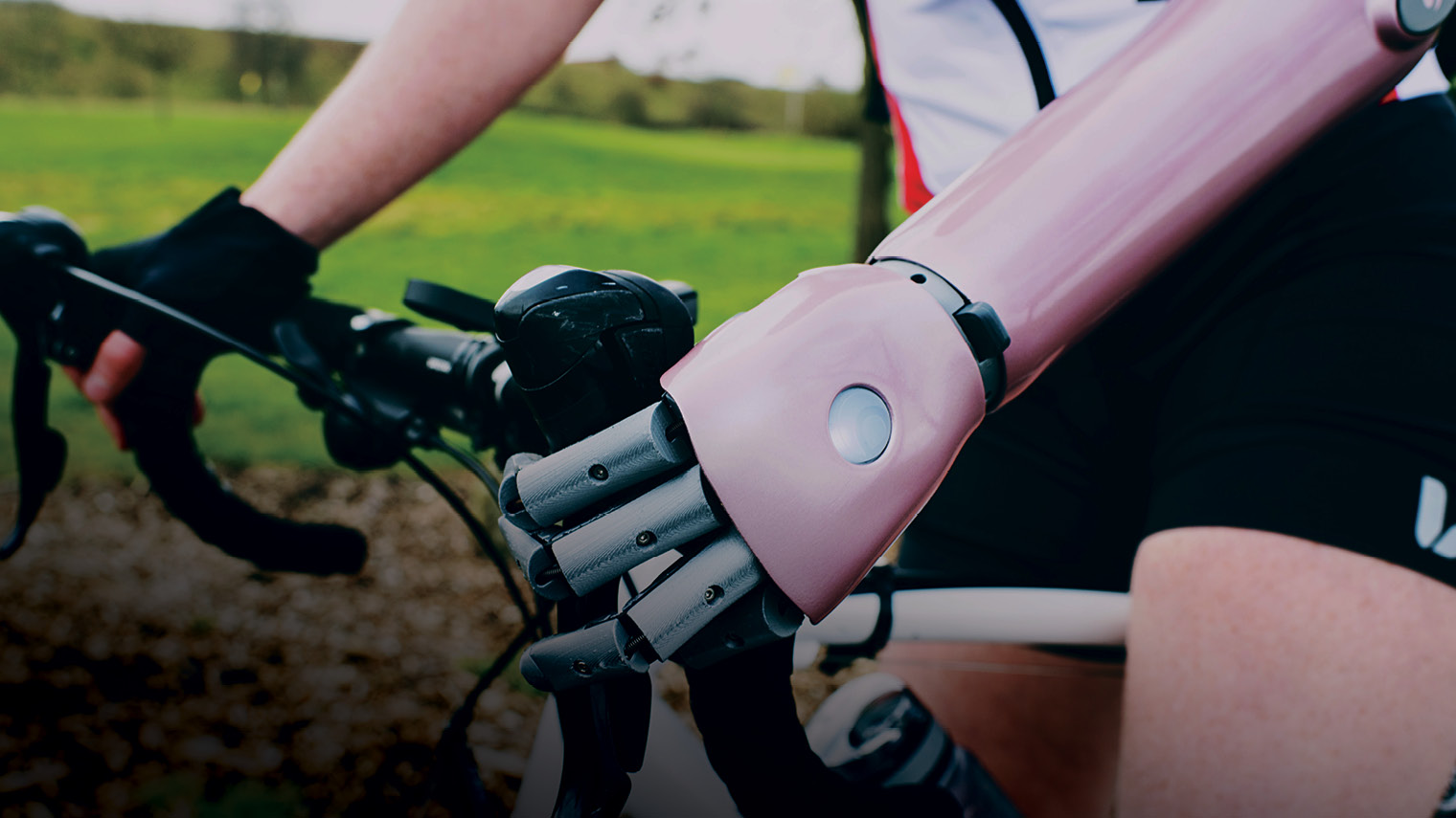 The race towards a bionic future - Raconteur
